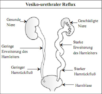 kidney in German laguage